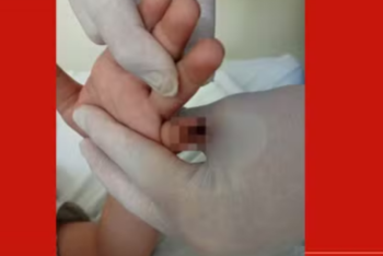 foto Notícia Samambaia